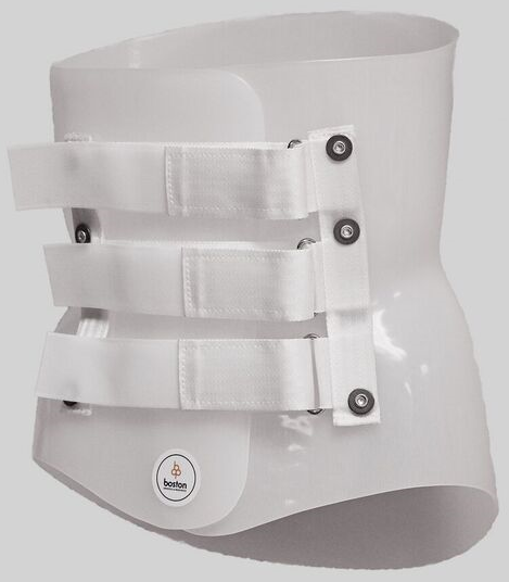 Health Management and Leadership Portal, Thoracolumbosacral (TLSO) support  corset / scoliosis / with hip brace Lock Joint Boston Brace