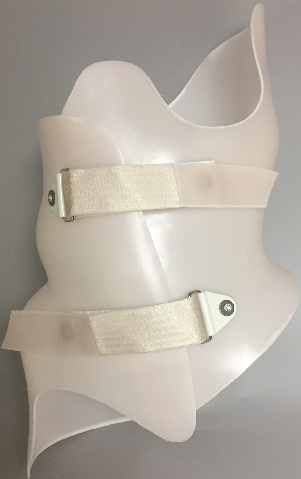 Custom Spinal Braces / BOSTON BRACE at Rs 15000/piece, Spinal Orthosis in  Chennai